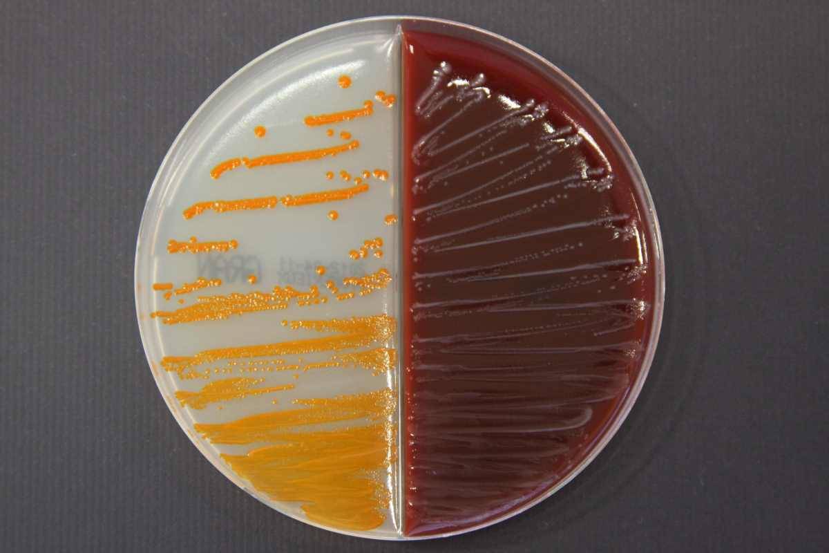 Streptococcus agalactiae culture on Granada agar and blood agar. © University of Tours, MEREGHETTI Laurent