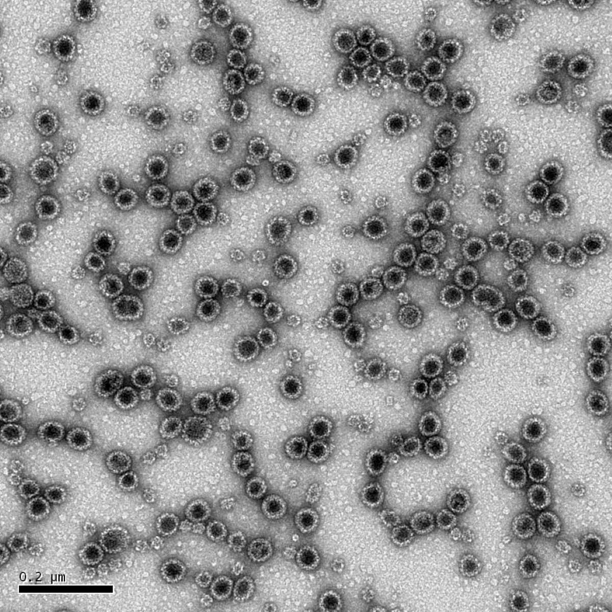 Virus-like particules of the Merkel cell Polyomavirus, obtained by the VP1 major protein expression and observed by transmission electron microscopy.