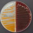 Streptococcus agalactiae culture on Granada agar and blood agar. © University of Tours, MEREGHETTI Laurent