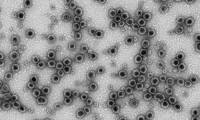 Virus-like particules of theMerkel cell Polyomavirus, obtained by the VP1 major protein expression and observed by transmission electron microscopy. © University of Tours, TOUZE Antoine, SIZARET P-Y