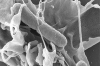 Cell surface rearrangements induced by Salmonella invasion mechanisms. © INRAE, WIEDEMANN A. - Univ. Tours, SIZARET P-Y