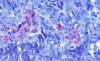 Detection of Mycobacterium bovis in mouse lungs 7 weeks post infection (modified Ziehl staining, magnification X 600). © INRAE, COCHARD Thierry